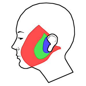 Facelift