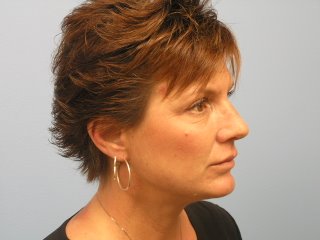 Dr Pena Plastic Surgery