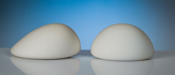 B-Lite implants weigh 30 percent less than conventional implants.