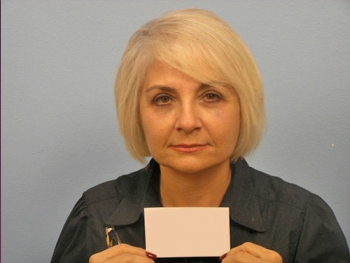 Before and After Facelift